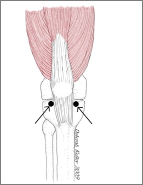 knee_V1 copy